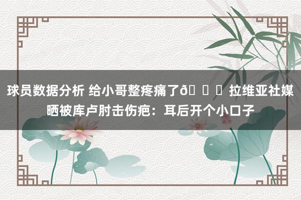 球员数据分析 给小哥整疼痛了😅拉维亚社媒晒被库卢肘击伤疤：耳后开个小口子